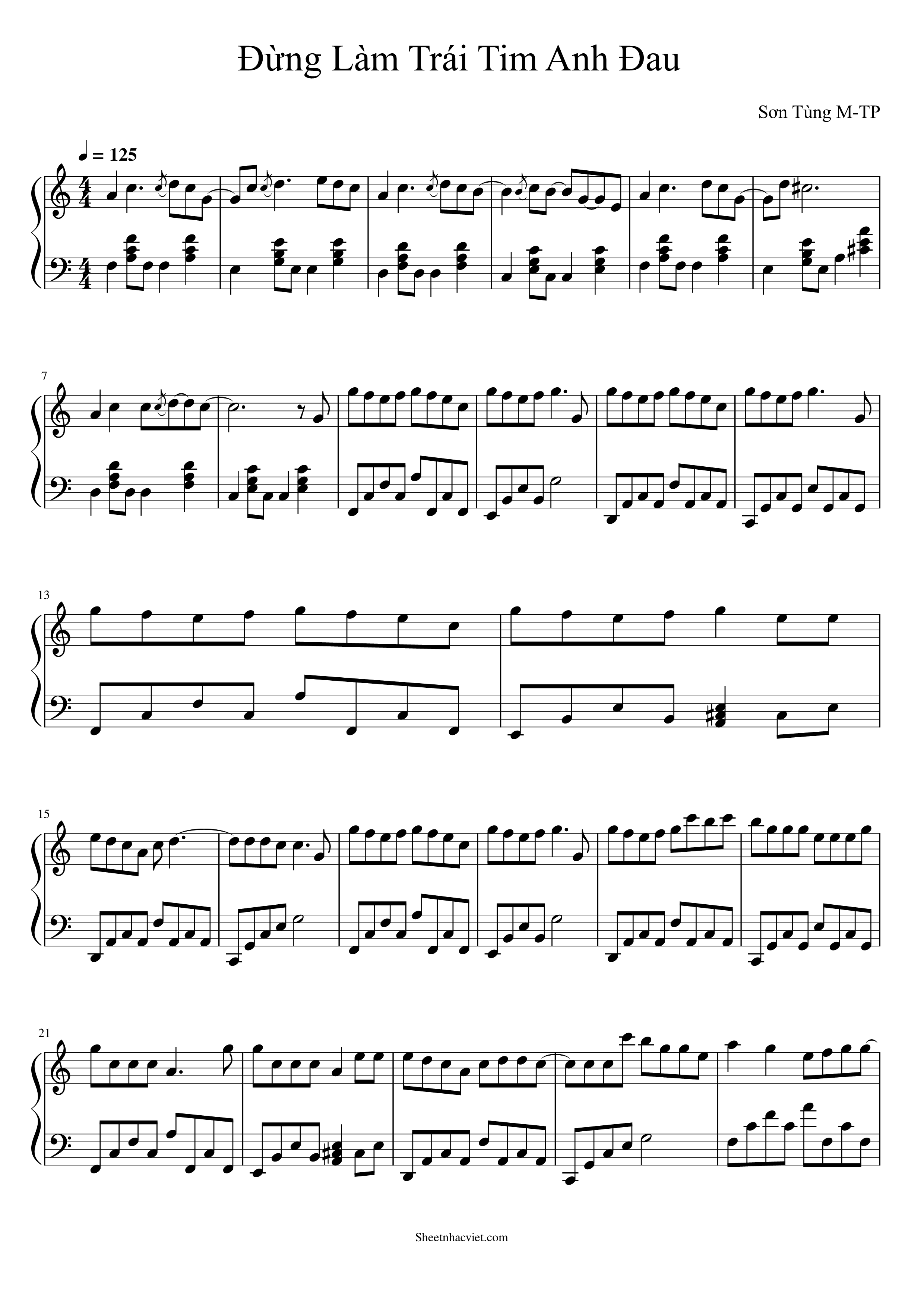 Đừng Làm Trái Tim Anh Đau – Sơn Tùng M-TP